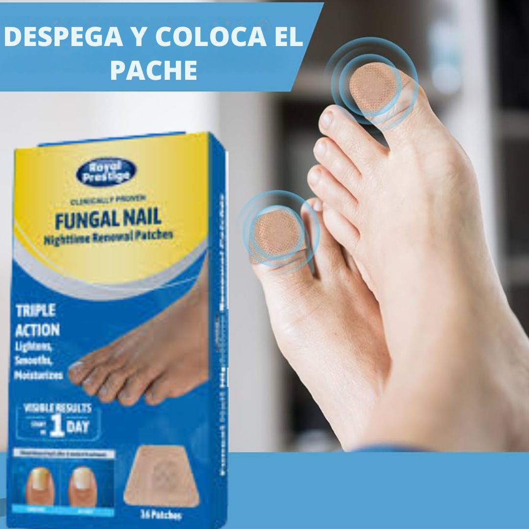 NailPure™ Parches Anti Hongos Uñas Encarnadas SUPER OFERTA 2x1🔥