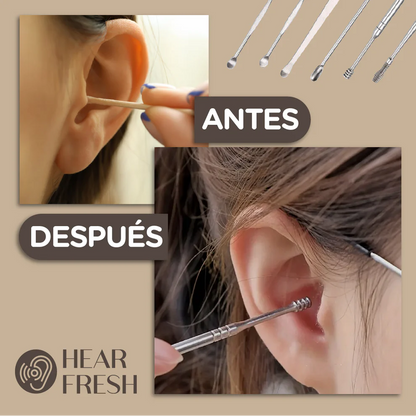 HEAR FRESH™ - Set de Limpieza de Oídos Profesional 👂OFERTA 2X1👂